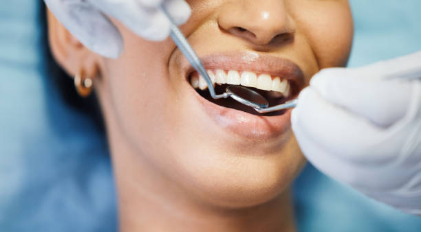 Best Emergency Dentist for Lost Fillings or Crowns in Maroa, IL